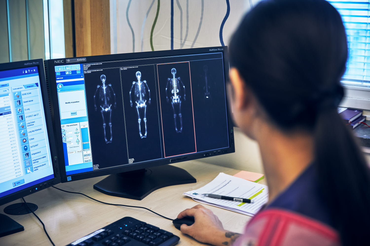 Röntgensjuksköterska framför bildskärmar med röntgenbild. Danderyds sjukhus, röntgen, nuklearmedicin. Oktober 2021.
